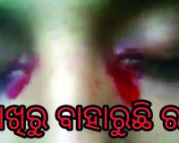 ଅଜବ ରୋଗ: ଆଖିରୁ ବାହାରୁଛି ରକ୍ତ