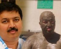 ସାଇବର ବିଶେଷଜ୍ଞ ସୂର୍ଯ୍ୟନନ୍ଦନଙ୍କ 'ଆଙ୍କିଲୋଜିଙ୍ଗ୍ ସ୍ପଣ୍ଡିଲାଇଟିସ୍' ସହ ସଂଗ୍ରାମ: ସୁସ୍ଥ ଜୀବନଶୈଳୀ ପାଇଁ ଦେଲେ ପରାମର୍ଶ