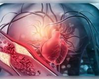 ୩୦ ବର୍ଷ ପୂର୍ବରୁ ନିୟନ୍ତ୍ରଣ କରନ୍ତୁ କୋଲେଷ୍ଟ୍ରଲ! ହୃଦଘାତ ଓ ଷ୍ଟ୍ରୋକ୍ ରୋକିବା ପାଇଁ ବିଶେଷଜ୍ଞଙ୍କ ନୂଆ ଗାଇଡଲାଇନ୍