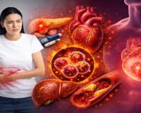 ଡାଇବେଟିସ୍, ଫ୍ୟାଟି ଲିଭର୍ ଓ ହୃଦରୋଗର ମୂଳ କାରଣ ସାଜୁଛି ‘ସାଇଲେଣ୍ଟ୍ ଇନଫ୍ଲାମେସନ୍’, ଜାଣନ୍ତୁ କିପରି ରହିବେ ସୁସ୍ଥ