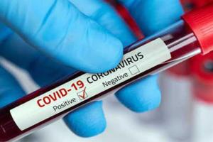 ଆଜି ରାଜଧାନୀରେ କରୋନାରୁ ସୁସ୍ଥ ଅଧିକ, ସଂକ୍ରମଣ କମ