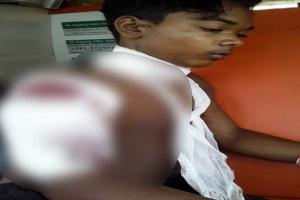 ଜଙ୍ଗଲକୁ ଛେଳି ଚରାଇବା ପାଇଁ ଯାଇଥିବା ବେଳେ ଶିକାରୀ ଗୁଳି ବାଜି ନାବାଳକ ଗୁରୁତର