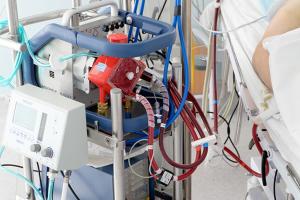 ଖୁବଶୀଘ୍ର ଭୁବନେଶ୍ୱର ଏମ୍ସରେ ସ୍ଥାପନ ହେବ ଦୁଇଟି ECMO ମେସିନ