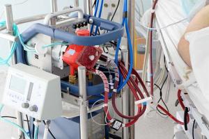 ଭୁବନେଶ୍ୱର ଏମ୍ସକୁ ଆସିଲା  ପ୍ରଥମ ECMO ମେସିନ୍