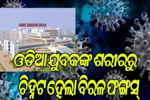 ଭୁବନେଶ୍ବର ଏମ୍ସ ଡାକ୍ତରଙ୍କ ସଫଳ ଗବେଷଣା, ଚିହ୍ନଟ ହେଲା ବିରଳ ଫଙ୍ଗସ୍‌