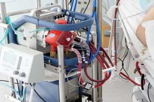 ଅଗଷ୍ଟ ୧୫ରୁ ଏସ୍‌ସିବିରେ ଆରମ୍ଭ ହେବ କରୋନା ରୋଗୀଙ୍କ ECMO ଚିକିତ୍ସା