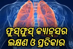 ଜାଣନ୍ତୁ ଫୁସ୍‌ଫୁସ୍ କ୍ୟାନ୍‌ସର କ’ଣ , ଏହାର ଲକ୍ଷଣ ଓ ପ୍ରତିକାର