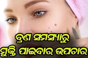 ବ୍ରଣ ସମସ୍ୟାରୁ ମୁକ୍ତି ପାଇବା ପାଇଁ ଜାଣନ୍ତୁ ଉପଚାର