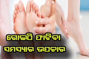 ଗୋଇଠି ଫାଟିବା ସମସ୍ଯାର ସମାଧନ ପାଇଁ ଜାଣନ୍ତୁ ଉପଚାର