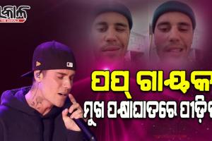 ଜଷ୍ଟିନ୍ ବିବରଙ୍କ ଫ୍ୟାନଙ୍କୁ ବଡ଼ ଝଟକା: ମୁଖ ପକ୍ଷାଘାତ ରୋଗରେ ଆକ୍ରାନ୍ତ ହେଲେ ପପ୍ ଗାୟକ ଜଷ୍ଟିନ ବିବର୍