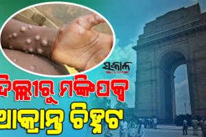 ଦେଶରେ ବ୍ୟାପୁଛି ମଙ୍କିପକ୍ସ : କେରଳ ପରେ ରାଜଧାନୀ ଦିଲ୍ଲୀରୁ ଚିହ୍ନଟ ହେଲା ଚତୁର୍ଥ ମାମଲା