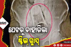 ମଦ୍ଯପ ସାଙ୍ଗଙ୍କ ଉନ୍ମତ କାଣ୍ଡ: ମଳଦ୍ବାର ପଟେ ଜୋରଜବରଦସ୍ତ ଭର୍ତ୍ତି କରାଇଲେ ଷ୍ଟିଲ ଗ୍ଲାସ