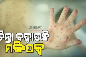 ପୁଣି କେରଳରୁ ଚିହ୍ନଟ ହେଲେ ଆଉ ଜଣେ ମଙ୍କିପକ୍ସ ଆକ୍ରାନ୍ତ