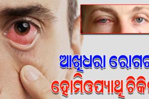 ଦ୍ରୁତଗତିରେ ବଢ଼ିଚାଲିଛି ଆଖିଧରା ରୋଗ, ଜାଣନ୍ତୁ କ’ଣ ରହିଛି ଏହାର ହୋମିଓପ୍ୟାଥି ଚିକିତ୍ସା ଓ ପ୍ରତିଷେଧକ…