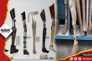 ଖୁବ ଶୀଘ୍ର ରାଜ୍ୟର ସମସ୍ତ ଜିଲ୍ଲାରେ ମିଳିବ କୃତ୍ରିମ ଅଙ୍ଗ ପ୍ରତିରୋପଣ ସୁବିଧା