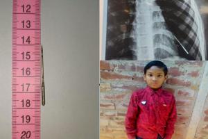 рммрм┐рмирм╛ рмЕрм╕рнНрмдрнНрм░рнЛрмкрмЪрм╛рм░рм░рнЗ рммрм╛рм╣рм╛рм░рм┐рм▓рм╛ рмЫрнБрмЮрнНрмЪрм┐, рмирнВрмЖ рмЬрнАрммрми рмжрнЗрм▓рм╛ рмнрнБрммрмирнЗрм╢рнНрн▒рм░ рмПрморнНрм╕