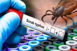 ସ୍କ୍ରବ୍‌ ଟାଇଫସ୍‌ ନେଲା ଆଉ ଜଣକ ଜୀବନ; ଗଡ଼ିଲାଣି ୬ ମୁଣ୍ଡ, ଶତାଧିକ ଆକ୍ରାନ୍ତ