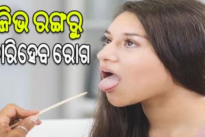 ଜିଭ ରଙ୍ଗରୁ ବାରିହେବ ରୋଗ…