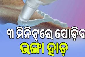 ୩ ମିନିଟ୍‌ରେ ଭଙ୍ଗା ହାଡ଼ ଯୋଡ଼ିବ ‘ବୋନ୍‌ ଗ୍ଲୁ’