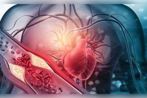 ୩୦ ବର୍ଷ ପୂର୍ବରୁ ନିୟନ୍ତ୍ରଣ କରନ୍ତୁ କୋଲେଷ୍ଟ୍ରଲ! ହୃଦଘାତ ଓ ଷ୍ଟ୍ରୋକ୍ ରୋକିବା ପାଇଁ ବିଶେଷଜ୍ଞଙ୍କ ନୂଆ ଗାଇଡଲାଇନ୍